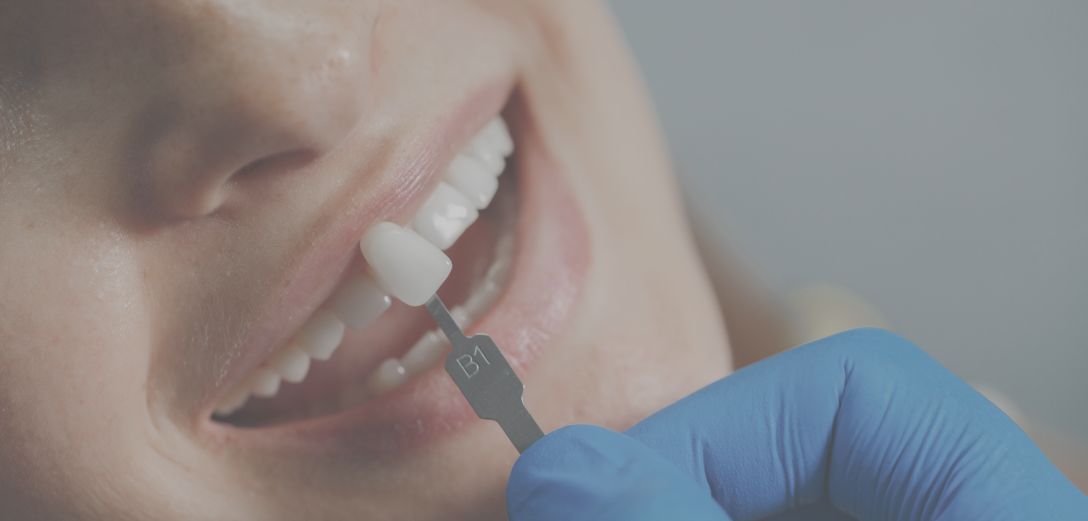Desde la Periodoncia a la Implantología