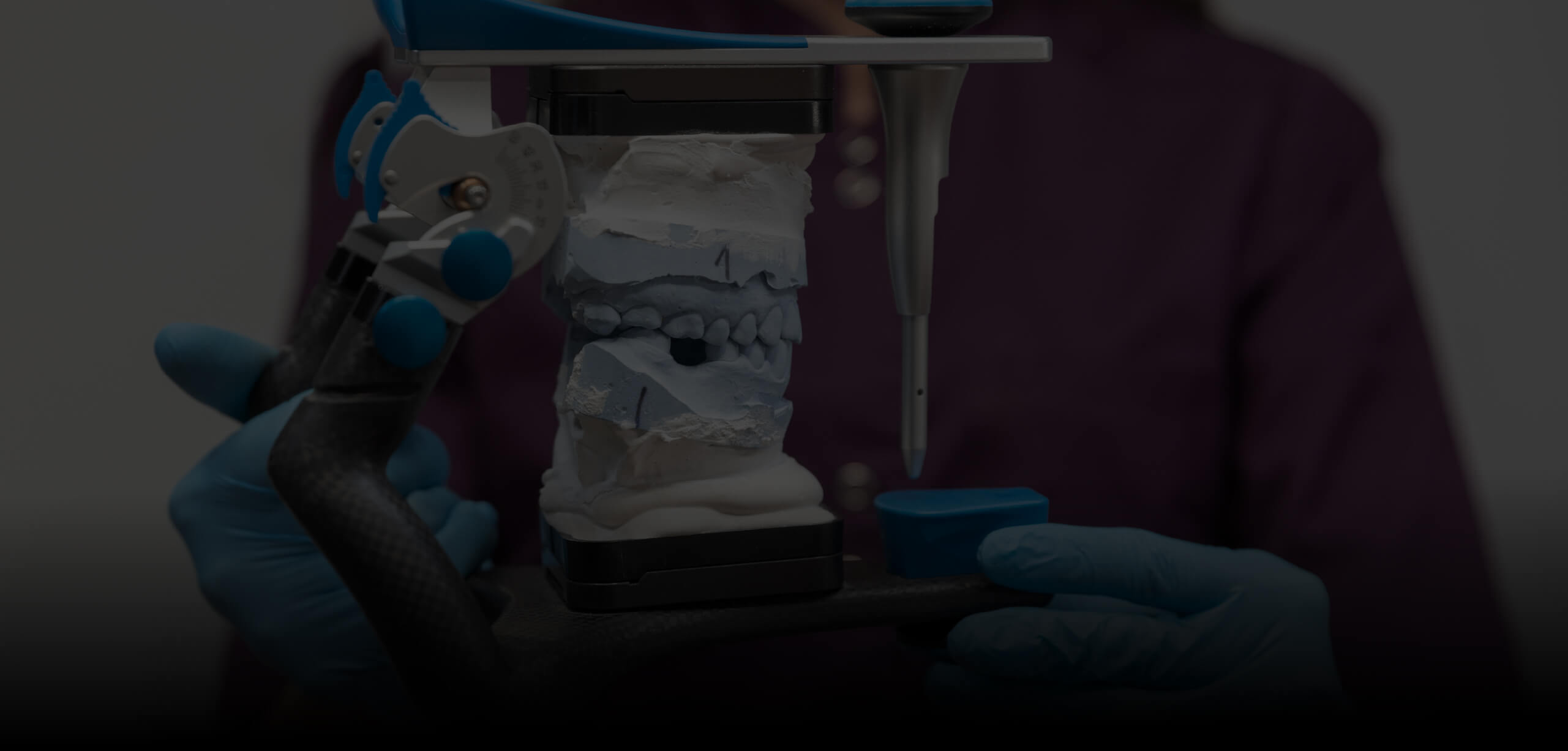 Anatomia dentária em implantologia: tecidos peri-implantares