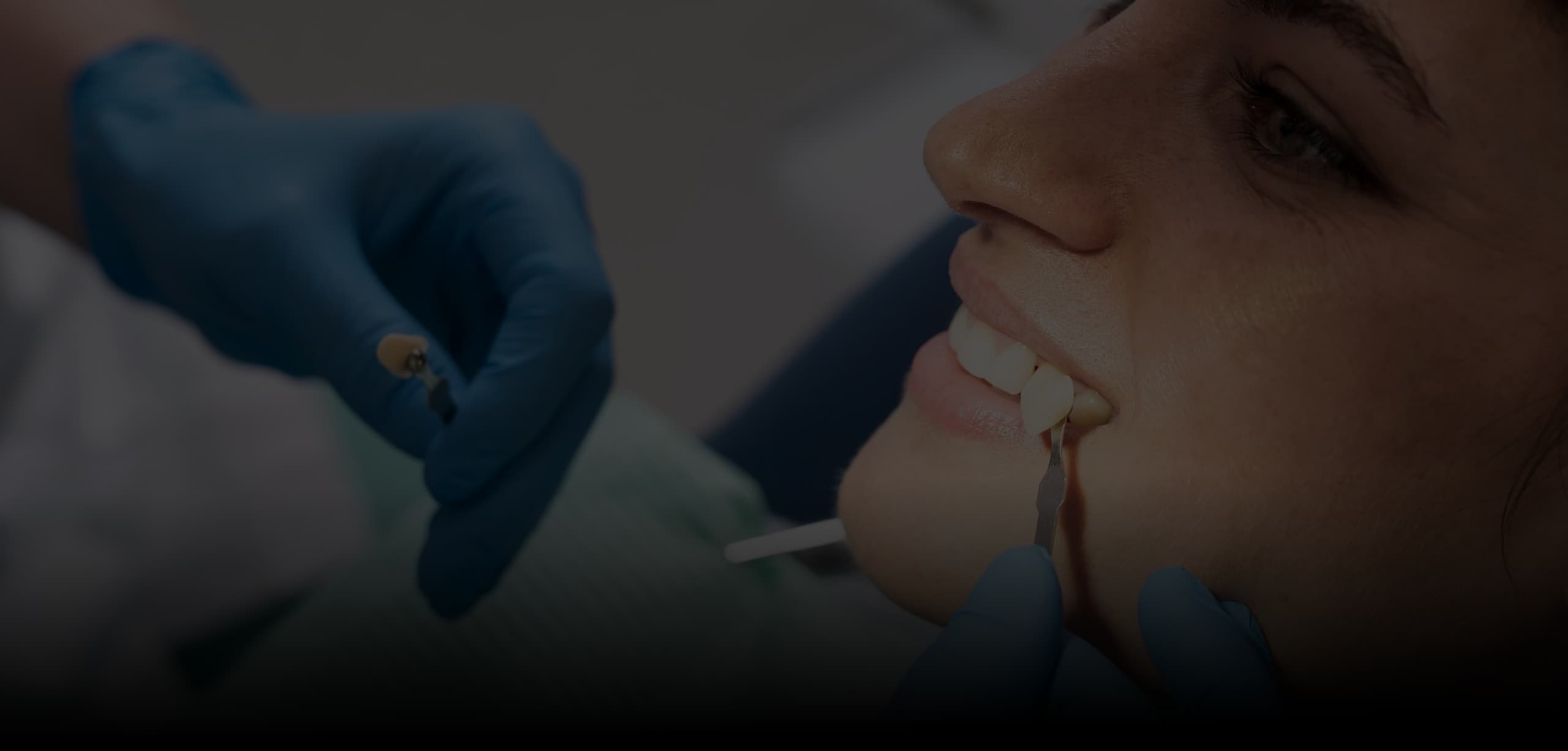 Odontología Adhesiva