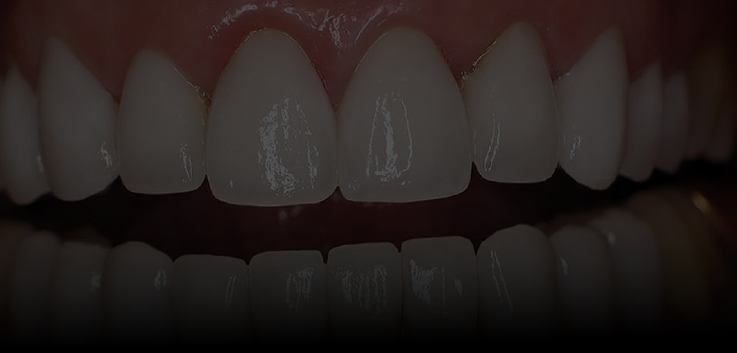Rehabilitación Oral Integral